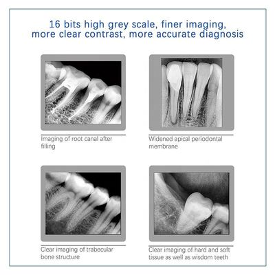Machine dentaire polyvalente d'USB X Ray, unité dentaire tenue dans la main sans fil de X Ray