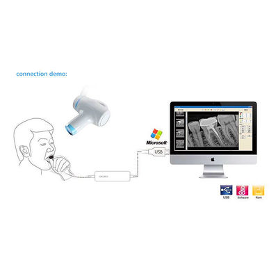 Traitement dentaire portatif tenu dans la main de X Ray Machine Camera For Endodontic