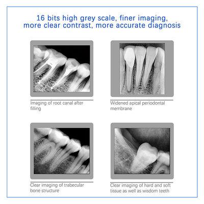 Capteur numérique de rayons X dentaires pour les implants dentaires et le traitement endodontique